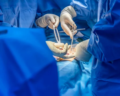 poza operatie interior jpg