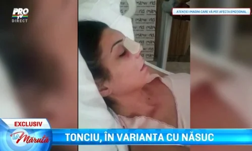 Andreea Tonciu este umflată după operaţie jpeg