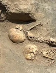 Intervenție chirurgicală craniană, descoperită la un copil din Epoca Bronzului, decedat la vârsta de 5 ani (© Italian Archaeological Mission in Uzbekistan)