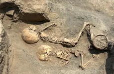 Intervenție chirurgicală craniană, descoperită la un copil din Epoca Bronzului, decedat la vârsta de 5 ani (© Italian Archaeological Mission in Uzbekistan)