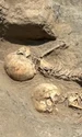 Intervenție chirurgicală craniană, descoperită la un copil din Epoca Bronzului, decedat la vârsta de 5 ani (© Italian Archaeological Mission in Uzbekistan)