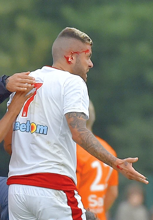 Menez a rămas fără jumătate din urechea dreaptă