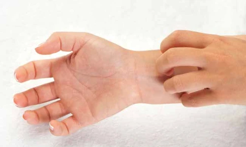 te mănâncă palmele jpeg