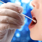 Testul rapid poate detecta infecția cu SARS-CoV-2 FOTO: shutterstock 