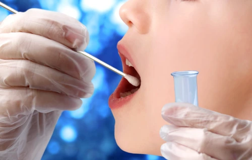 Testul rapid poate detecta infecția cu SARS-CoV-2 FOTO: shutterstock 
