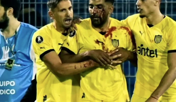 Fotbalistul a avut nevoie de îngrijiri medicale (FOTO: Captură Youtube)
