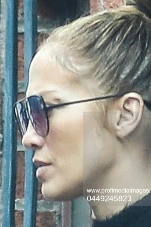 J Lo a apărut pe stradă în urmă cu ceva vreme cu o tăietură în jurul ochilor