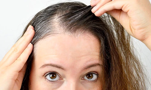 1 remediu fire de par alb jpg jpeg