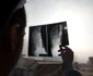 O fată urmăreşte o eclipsă solară printr-o radiografie a piciorului văzută din Islamabad Kuweit FOTO AFP / Amir Qureshi