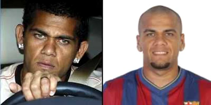 Dani Alves şi-a lipit urechile chirurgical FOTO