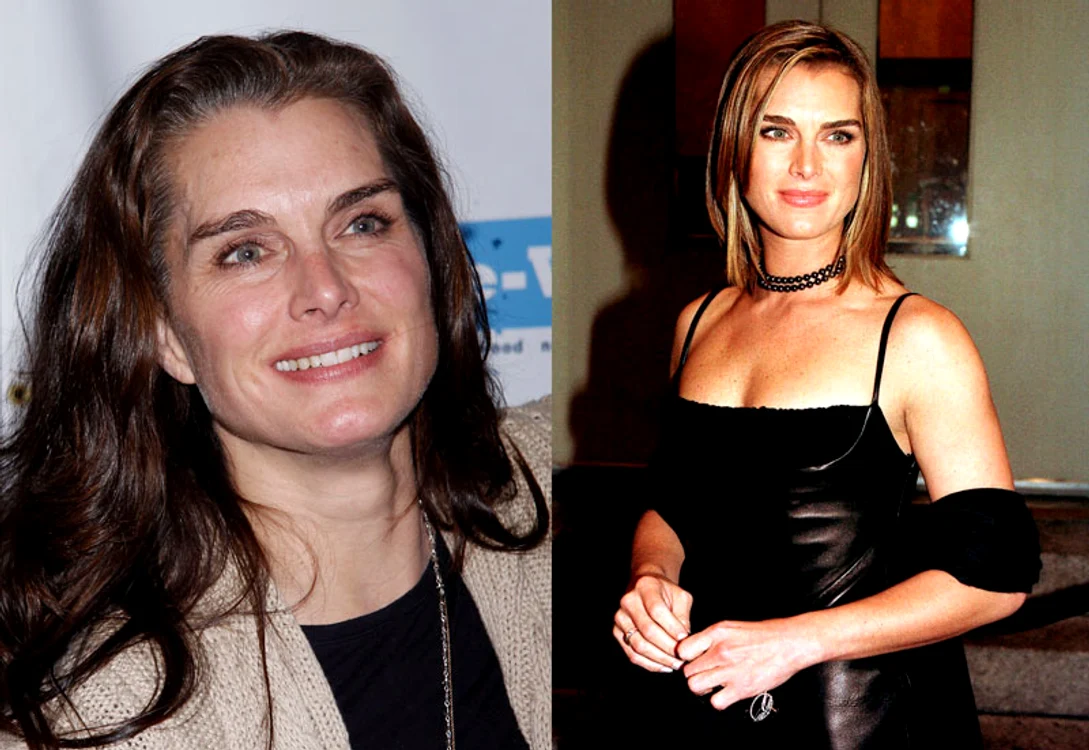 brooke shields