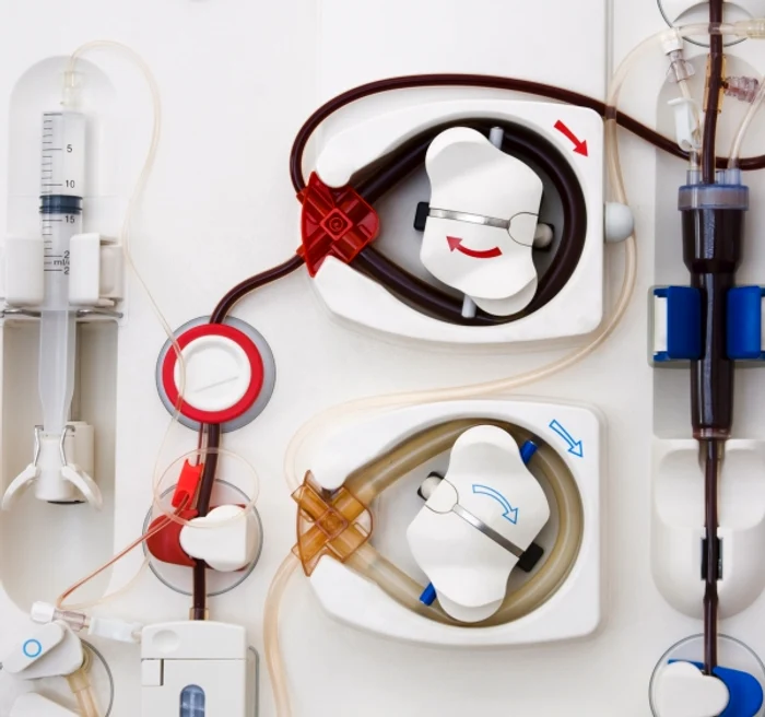 Se impune tratament prin dializă când diverse boli de rinichi au ajuns în stadiul de insuficienţă renală avansată.www.clicksanatate.ro