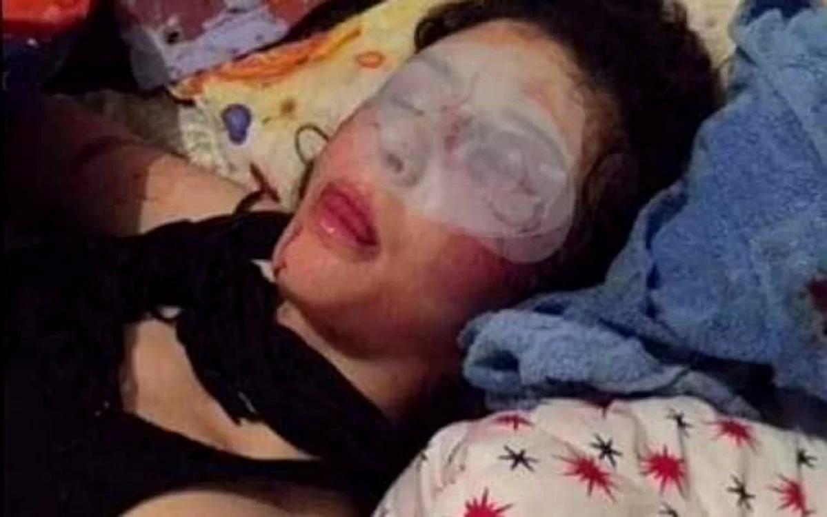 Fata a fost filmată în baie, în cadă, parţial dezbrăcată, plină de răni pe faţă, pe corp şi la mâini