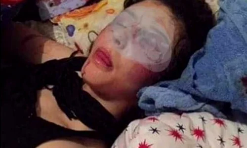 Fata a fost filmată în baie, în cadă, parţial dezbrăcată, plină de răni pe faţă, pe corp şi la mâini jpeg