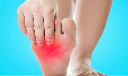 senzaţie de arsură în talpa piciorului jpeg