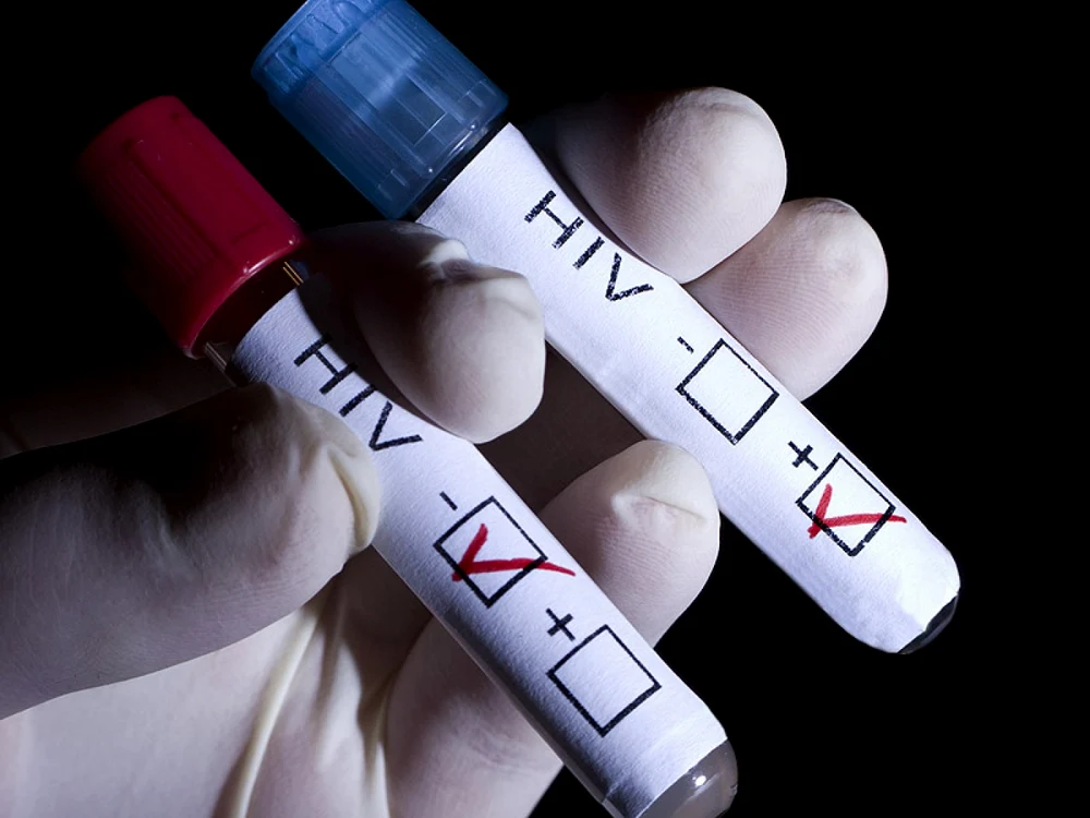 analize hiv