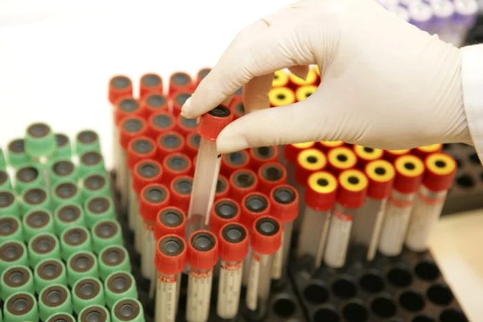 Copilul a consumat brânză de vaci infectată cu bacteria E. ColiFoto Hepta