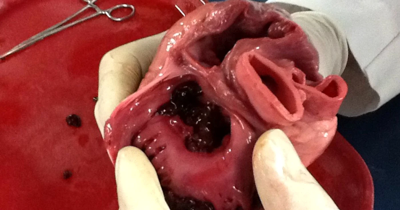 inima heart foto wikimedia commons