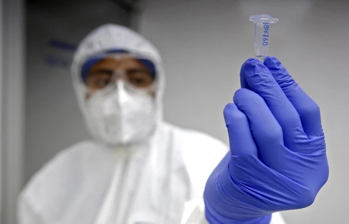 Comisia Europeană a pus pe piaţă un nou test PCR, pentru Omicron foto: AFP