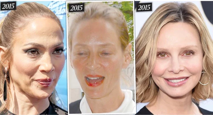 
    Jennifer Lopez, Calista Flockhart şi Uma Thurman au fost  devastate de riduri, botox şi exces de tratamente cosmeticeFoto: Guliver / Splashnews / Gettyimages / Ap / Hepta  