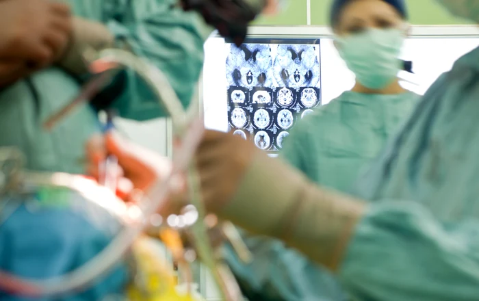 Medicul a păsărit pacientul sedat pentru a face sex. FOTO: arhivă