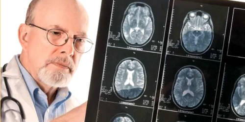 Activitatea mintală protejează creierul în faţa Alzheimerului