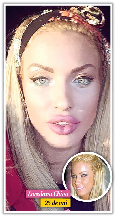 
    Loredana Chivu a exagerat cu implanturileFoto: Click!  