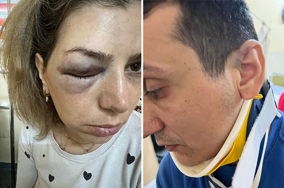 Cuplu snopit în bătaie de muncitorii unei primării din Vaslui. Femeia: „Mi-a tras un pumn în ochi“