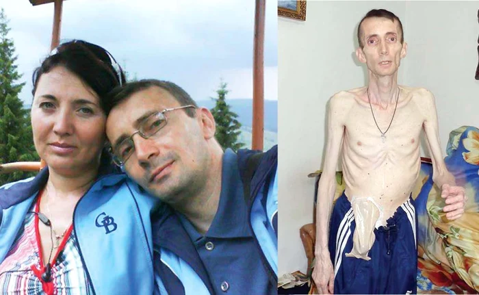 Ieşeanul Eugen Movilă a ajuns la 29 kg după o operaţie de peritonită