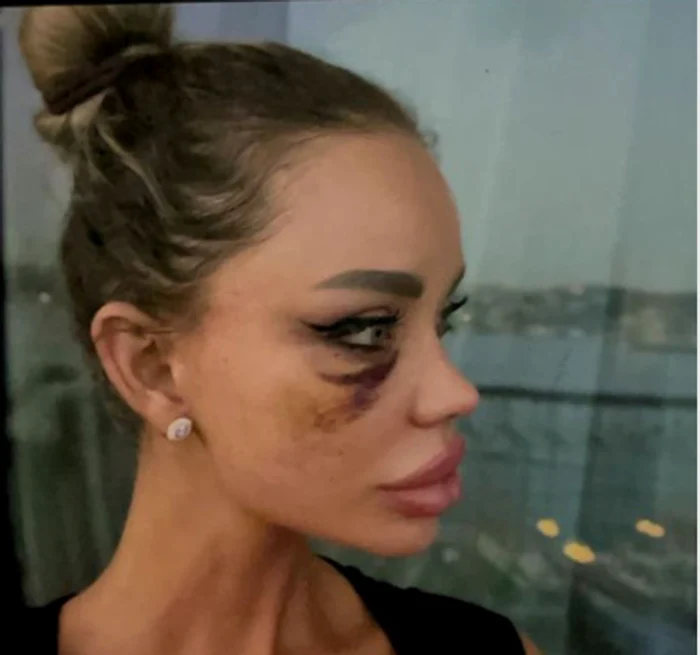 
    Alex Bodi și Bianca Drăgușanufoto: Instagram  