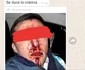 Poliţist din Vâlcea - Secţia 4 Prundeni desfigurat şi ameninţat de un clan de romi la Călina - Vâlcea Foto Adevărul - credit DMS