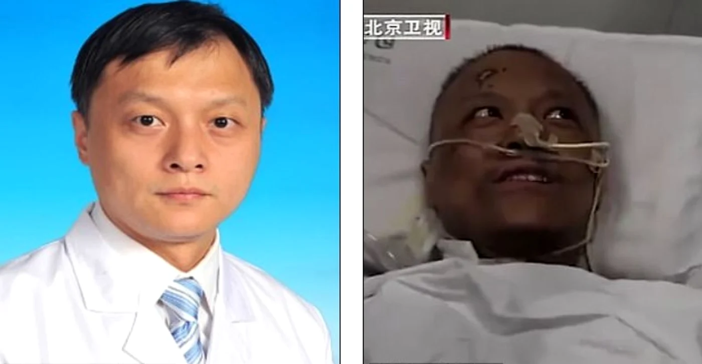 Medicul Yi Fan s-a trezit și el din comă cu pielea neagră. În prezent, s-a recuperat complet