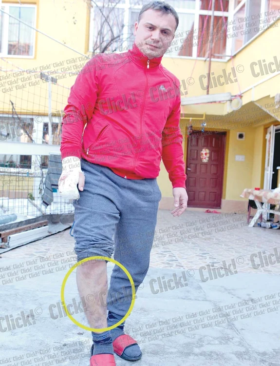 Marian Crăciun a fost tăiat la mână şi la picior de agresori cu sabia