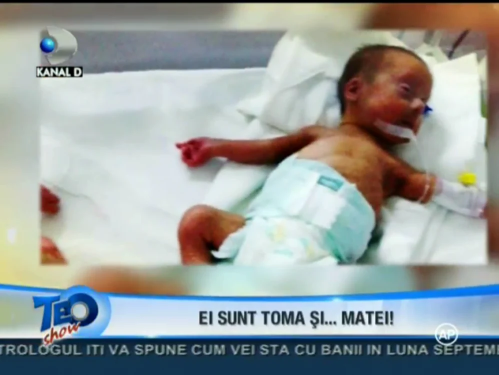 Unul dintre gemeni (captură: Kanal D)