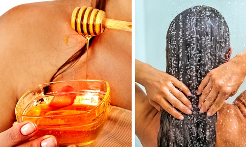 1 mierea te scapa de matreata acesta este tratamentul care iti vindeca scalpul intr o saptamana ae9j jpg jpeg