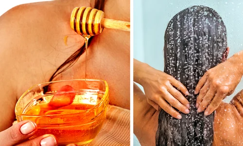 1 mierea te scapa de matreata acesta este tratamentul care iti vindeca scalpul intr o saptamana ae9j jpg jpeg