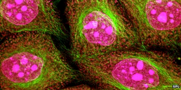 proteine din sange care anunta cancerul de col uterin foto bbc