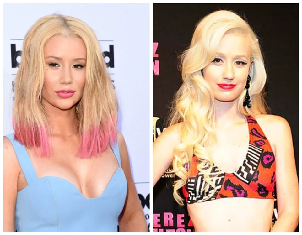 
    Înainte și după. Iggy Azalea a recunoscut că a apelat la o astfel de procedurăfoto: Arhiva personală  