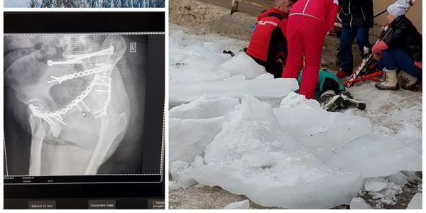O schioare a fost ranita grav de gheata cazuta de pe acoperisul unei terase din Vartop 1 jpg