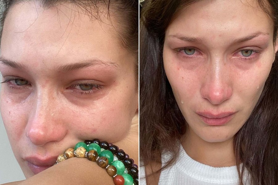 Coșmarul Lyme! Familia Hadid și cântăreața Adda, suferințe cumplite din cauza infecției date de mușcătura de căpușă: „Mi-a paralizat piciorul pe ambreiaj”