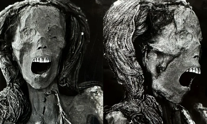 frontiers medicine screaming woman mummy credit sahar saleem 06 png