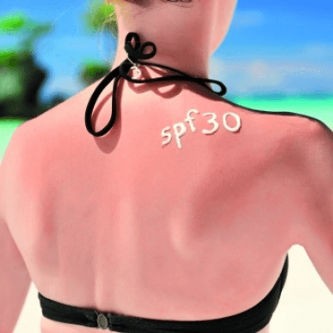 Content image