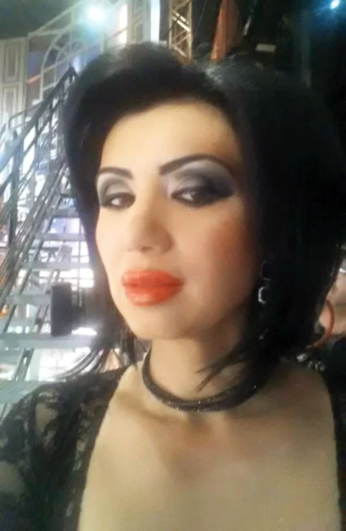 Adriana Bahmuţeanu - 41 de ani Şi-a mărit buzele cu acid hialuronic. O astfel de intervenţie costă aproximativ 250 de euro, iar efectul ţine până la 6 luni