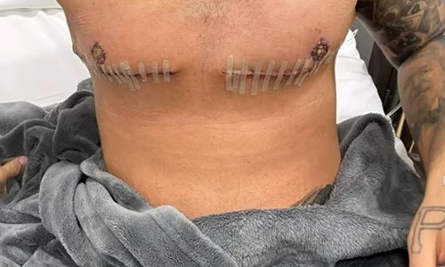 Lino Golden a împărtășit cu fanii o poză de pe patul de spital jpeg