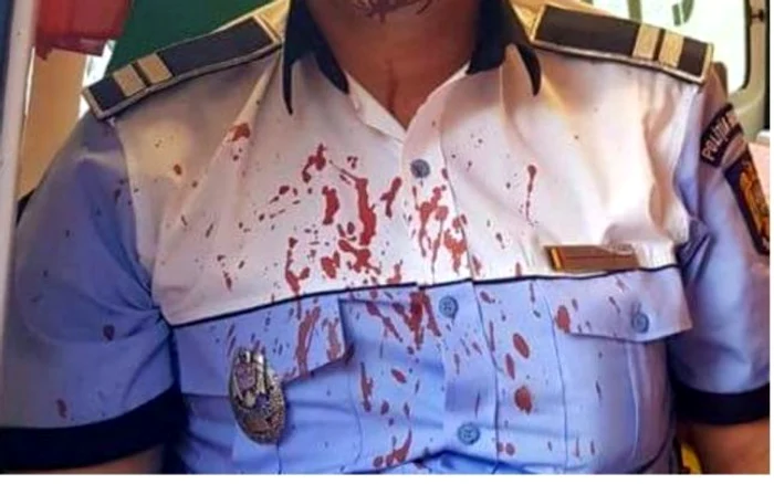 Poliţist lovit violent în timpul unei intervenţii FOTO Sindicatul Europol