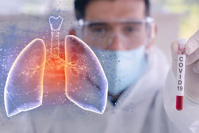 Virusul SARS-CoV-2 atacă în principal plămânii persoanei infectateSursă foto: Shutterstock