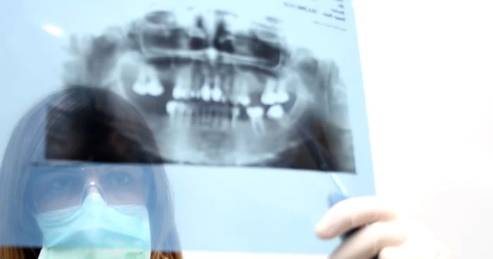 O radiografie panoramică iradiază de trei-patru ori mai mult decât una simplă