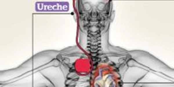Stimularea creierului cu  cipuri poate cauza schimbări de personalitate 