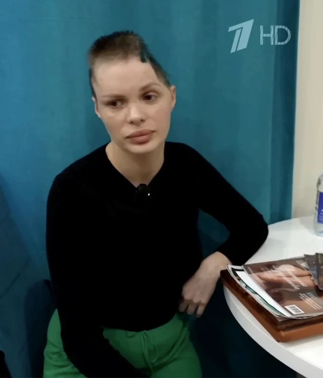 Anzhelika Tartanova a rămas cu sechele pe viață (Foto: Profimedia)