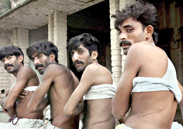 
    În India, mii de oameni  îşi vând organele pe  preţuri de nimic  